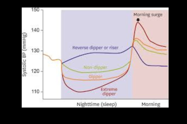 Dipper and Non Dipper