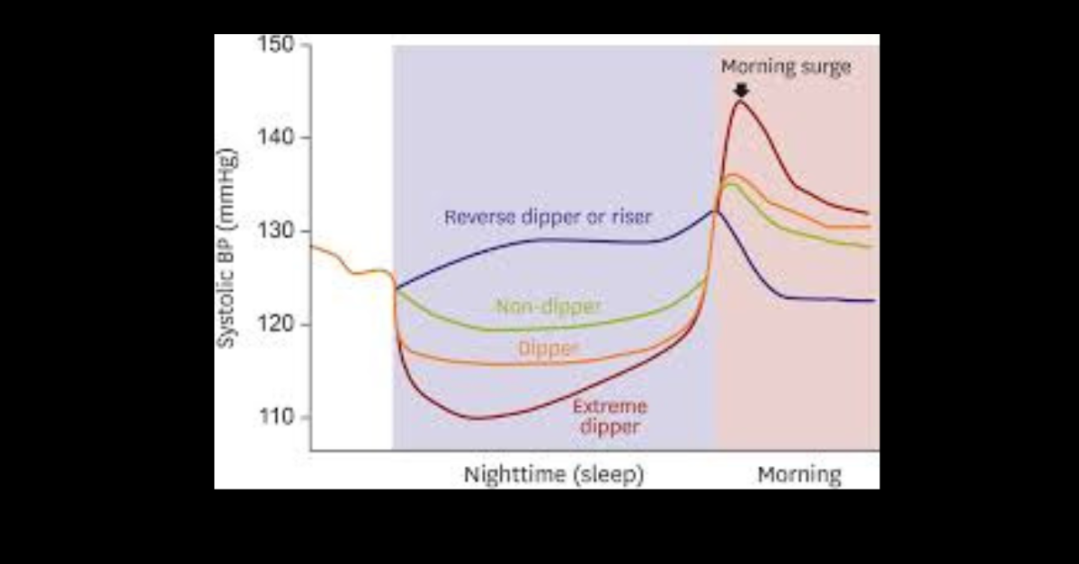 Dipper and Non Dipper